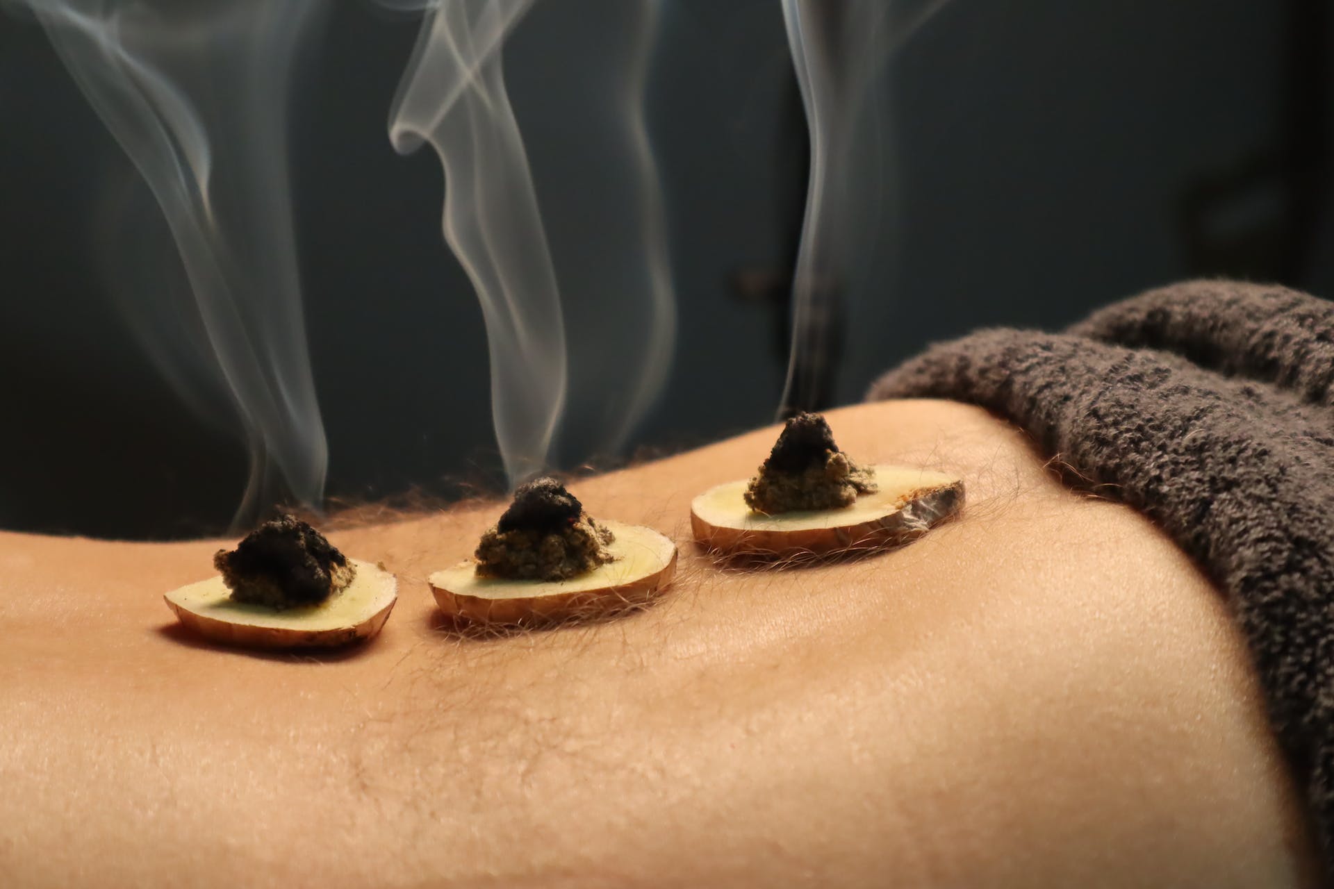 moxa therapie